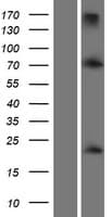 Human TWIST1 / TWIST Protein (Over-Expression Lysate Myc-DDK (Flag))