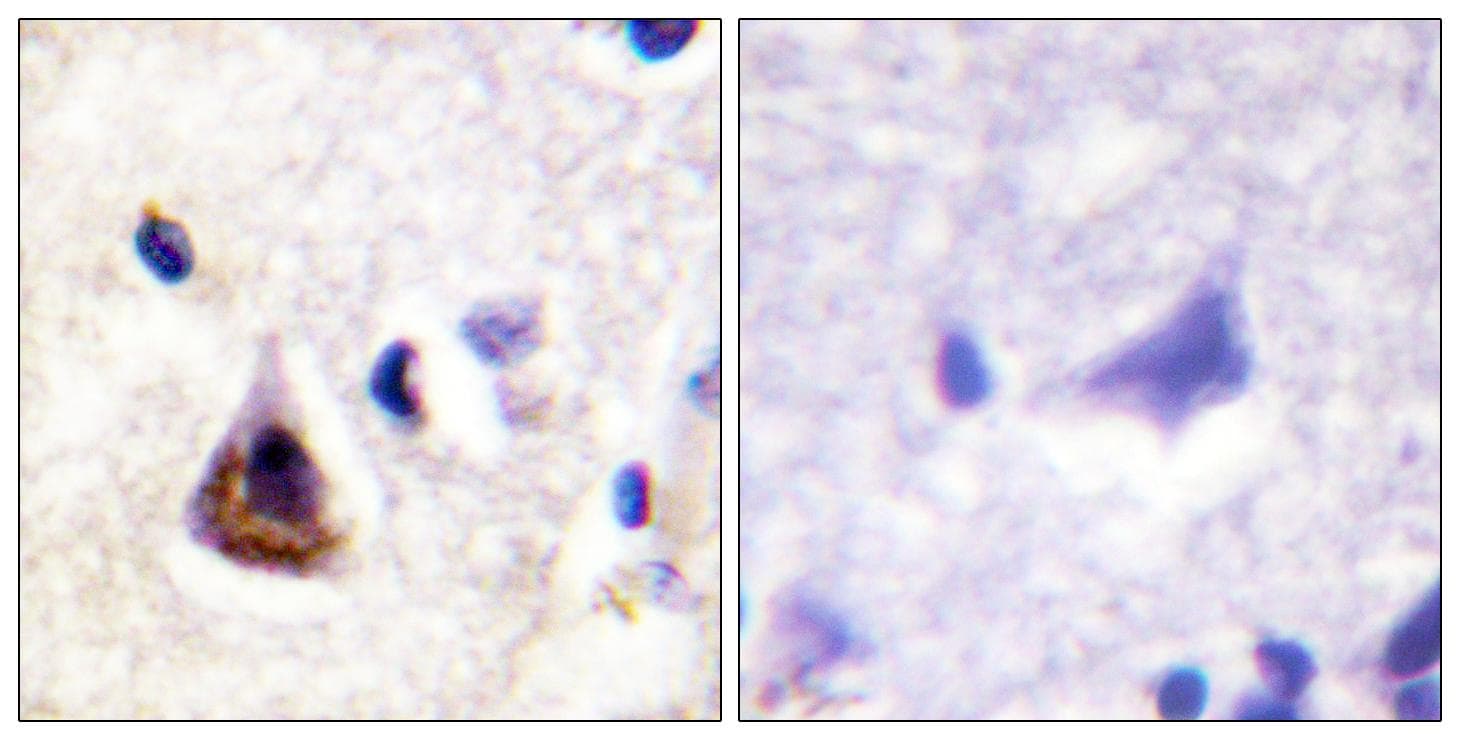 PIK3R1 / p85 Alpha Antibody (Ab-607)