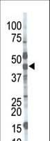 Polyclonal Rabbit anti-Human MGAT / GLYT1 Antibody (aa16-46, IHC, WB)