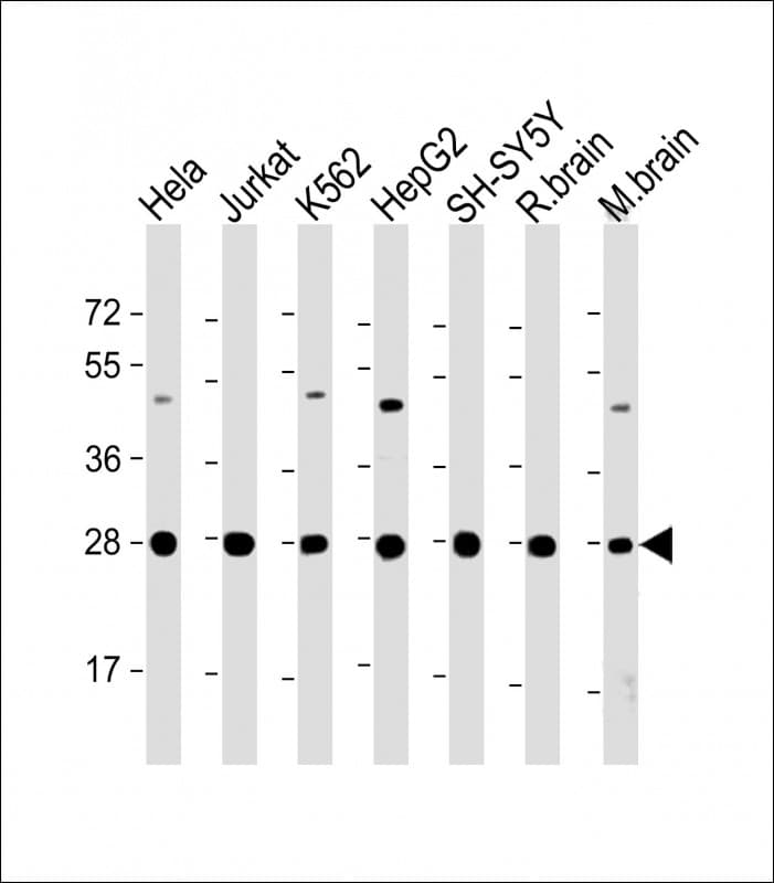 Polyclonal Rabbit anti-Human HSD17B10 / HADH2 Antibody (Internal, IHC, IF, WB)