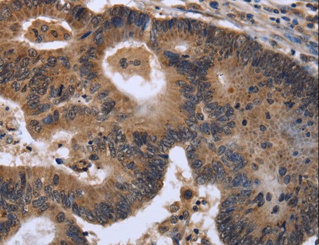 Polyclonal Rabbit anti-Human FGF21 Antibody (IHC)
