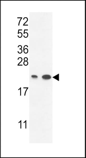 Polyclonal Rabbit anti-Human ABHD14B Antibody (aa150-179, IHC, WB)