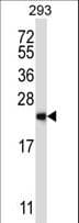 RAB1B Antibody (aa166-194)