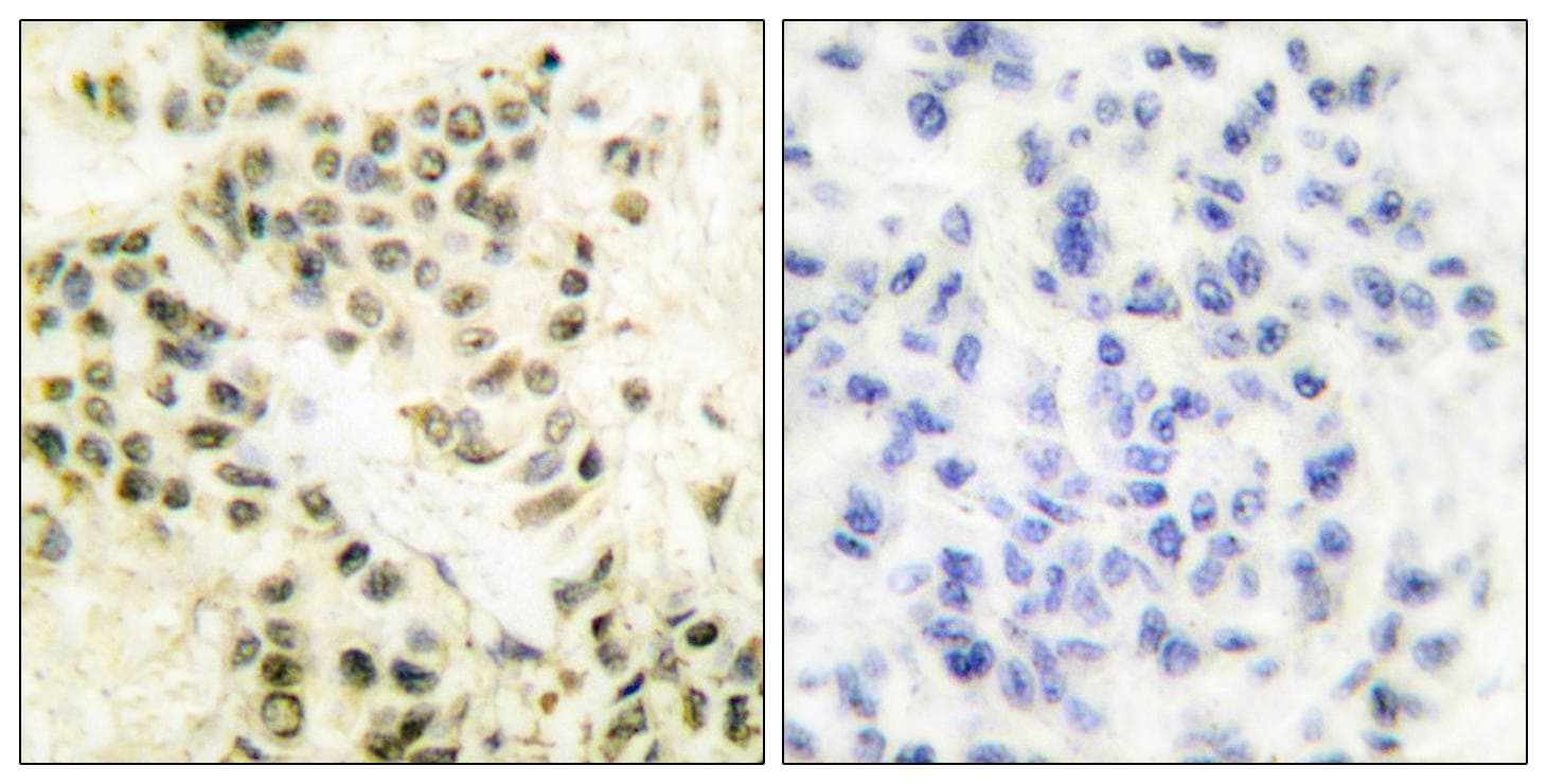 PRKDC / DNA-PKcs Antibody