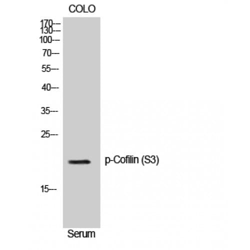 Cofilin Antibody (10-90 aa)