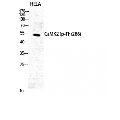 CaMKII Alpha+Delta Antibody (230-310 aa)
