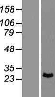 PRX-1 / PRRX1 Protein (Over-Expression Lysate Myc-DDK (Flag))