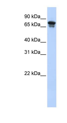Polyclonal Rabbit anti-Human KIF22 / OBP Antibody (aa72-121, WB)