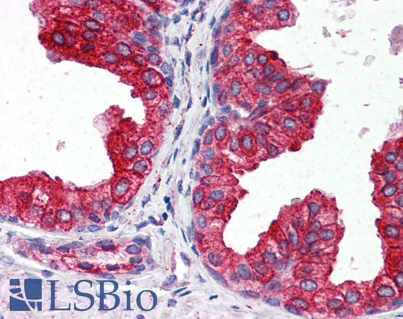 IHC-plus™ CYB5A / Cytochrome b5 Antibody (clone 4C2)