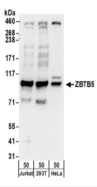 ZBTB5 Antibody (aa525-575)