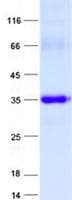 Human ZNF80 Protein (Recombinant His, N-Terminal)