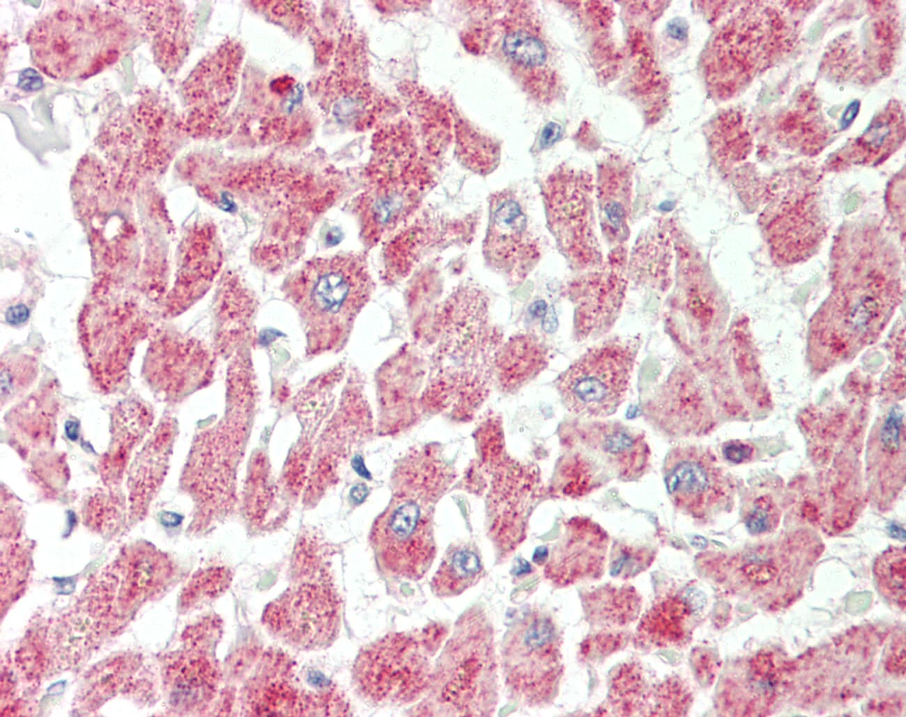 PINK1 Antibody (aa91-140)