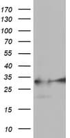 EXOSC7 Antibody (clone OTI1F4)