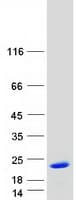 Human FIS1 Protein (Recombinant Myc-DDK (Flag))