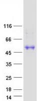 Human DCN / Decorin Protein (Recombinant Myc-DDK (Flag))