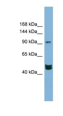 MAML3 / CAGH3 Antibody (aa791-840)