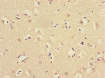 UBE2Z / USE1 Antibody