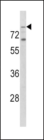 TLR2 Antibody (aa212-242)
