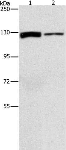 Polyclonal Rabbit anti-Human ACLY / ATP Citrate Lyase Antibody (WB)