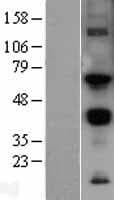Human MMP14 Protein (Over-Expression Lysate Myc-DDK (Flag))