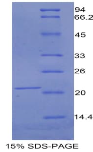 Mouse CD118 / LIF Receptor Alpha Protein (Recombinant His)