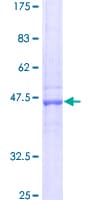 Human GSTM1 Protein (Recombinant GST)