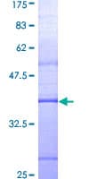 Human MYD88 Protein (Recombinant GST, N-terminus)
