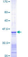 Human SMARCA4 / BRG1 Protein (Recombinant GST, N-terminus)