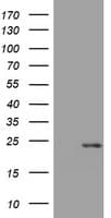 Monoclonal Mouse anti-Human VILIP / VSNL1 Antibody (clone OTI2G3, WB)