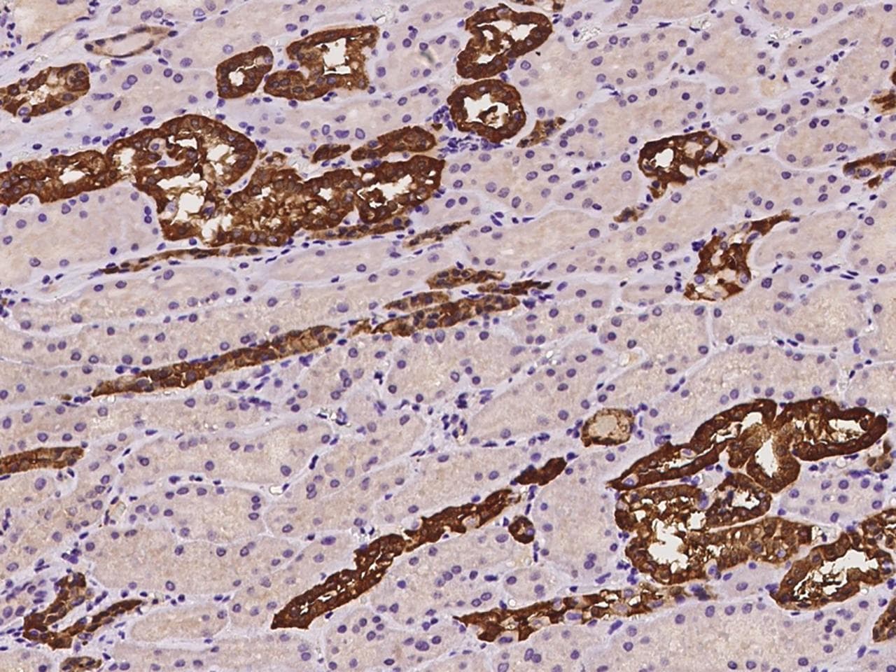 GSTM3 Antibody