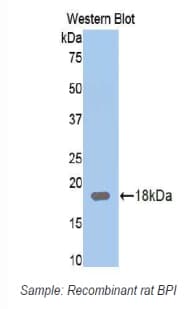 BPI Antibody (aa320-452)