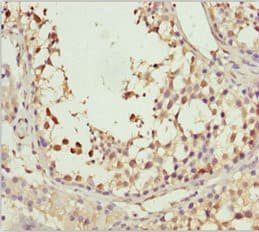 Polyclonal Rabbit anti-Human SPRED2 Antibody (IHC)