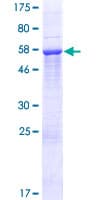 Human LDHA / LDH1 Protein (Recombinant GST)