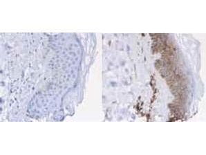 B2M / Beta 2 Microglobulin Antibody (Lyophilized, HRP)