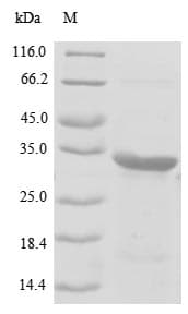 Pig Rhodopsin / RHO Protein (Recombinant GST-6His, N-terminus)