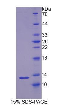 Pig RETN / Resistin Protein (Recombinant His-S)