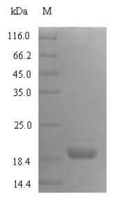 Rat ICOS / CD278 Protein (Recombinant 6His, N-terminus)