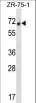 RCOR1 / COREST Antibody (aa101-130)