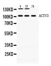 ACTN3 Antibody
