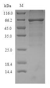 Mouse ALB / Serum Albumin Protein (Recombinant 6His, N-terminus)