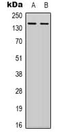 ITGB1 / Integrin Beta 1 / CD29 Antibody (C-Terminus)