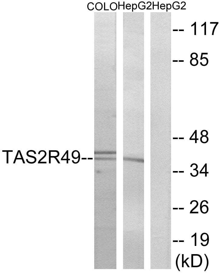 TAS2R20 / TAS2R49 Antibody