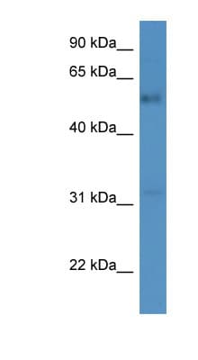 FAM126A / HCC Antibody (aa342-391)