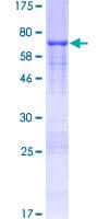 Human DKK3 Protein (Recombinant GST)