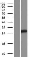 TMED5 Protein (Over-Expression Lysate Myc-DDK (Flag))