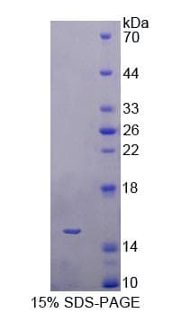 Human BAMBI Protein (Recombinant His-T7)