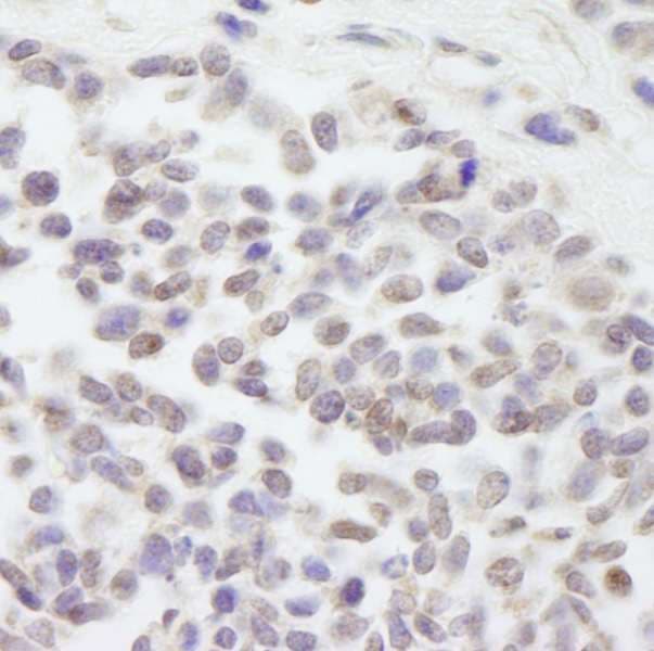 CUL3 / Cullin 3 Antibody (aa650-700)