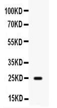 WFDC2 / HE4 Antibody
