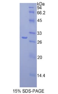 Mouse FASN / Fatty Acid Synthase Protein (Recombinant His)