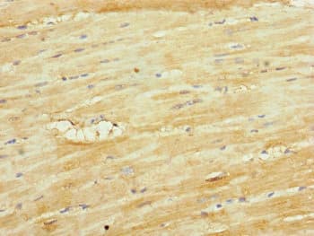 UQCR10 / UCRC Antibody